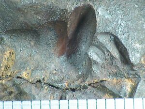 Significant metal loss in circumferential weld associated with cracking
